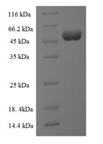 (Tris-Glycine gel) Discontinuous SDS-PAGE (reduced) with 5% enrichment gel and 15% separation gel. (Tris-Glycine gel) Discontinuous SDS-PAGE (reduced) with 5% enrichment gel and 15% separation gel.