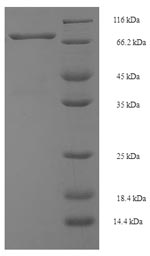 (Tris-Glycine gel) Discontinuous SDS-PAGE (reduced) with 5% enrichment gel and 15% separation gel. (Tris-Glycine gel) Discontinuous SDS-PAGE (reduced) with 5% enrichment gel and 15% separation gel.