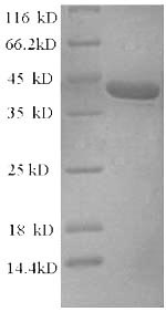 SDS-PAGE- Recombinant protein Rat Snca