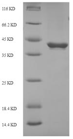 (Tris-Glycine gel) Discontinuous SDS-PAGE (reduced) with 5% enrichment gel and 15% separation gel. (Tris-Glycine gel) Discontinuous SDS-PAGE (reduced) with 5% enrichment gel and 15% separation gel.