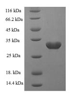 (Tris-Glycine gel) Discontinuous SDS-PAGE (reduced) with 5% enrichment gel and 15% separation gel. (Tris-Glycine gel) Discontinuous SDS-PAGE (reduced) with 5% enrichment gel and 15% separation gel.