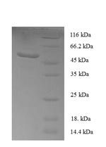 (Tris-Glycine gel) Discontinuous SDS-PAGE (reduced) with 5% enrichment gel and 15% separation gel. (Tris-Glycine gel) Discontinuous SDS-PAGE (reduced) with 5% enrichment gel and 15% separation gel.