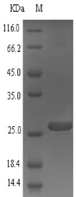(Tris-Glycine gel) Discontinuous SDS-PAGE (reduced) with 5% enrichment gel and 15% separation gel. (Tris-Glycine gel) Discontinuous SDS-PAGE (reduced) with 5% enrichment gel and 15% separation gel.