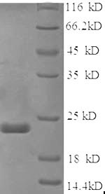 (Tris-Glycine gel) Discontinuous SDS-PAGE (reduced) with 5% enrichment gel and 15% separation gel. (Tris-Glycine gel) Discontinuous SDS-PAGE (reduced) with 5% enrichment gel and 15% separation gel.