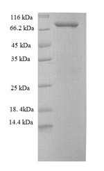 (Tris-Glycine gel) Discontinuous SDS-PAGE (reduced) with 5% enrichment gel and 15% separation gel. (Tris-Glycine gel) Discontinuous SDS-PAGE (reduced) with 5% enrichment gel and 15% separation gel.