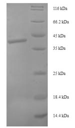 (Tris-Glycine gel) Discontinuous SDS-PAGE (reduced) with 5% enrichment gel and 15% separation gel. (Tris-Glycine gel) Discontinuous SDS-PAGE (reduced) with 5% enrichment gel and 15% separation gel.