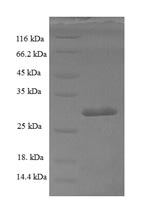 (Tris-Glycine gel) Discontinuous SDS-PAGE (reduced) with 5% enrichment gel and 15% separation gel. (Tris-Glycine gel) Discontinuous SDS-PAGE (reduced) with 5% enrichment gel and 15% separation gel.
