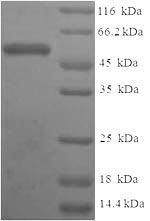 (Tris-Glycine gel) Discontinuous SDS-PAGE (reduced) with 5% enrichment gel and 15% separation gel. (Tris-Glycine gel) Discontinuous SDS-PAGE (reduced) with 5% enrichment gel and 15% separation gel.