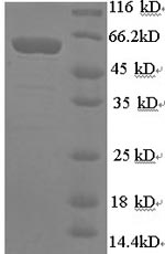 (Tris-Glycine gel) Discontinuous SDS-PAGE (reduced) with 5% enrichment gel and 15% separation gel. (Tris-Glycine gel) Discontinuous SDS-PAGE (reduced) with 5% enrichment gel and 15% separation gel.