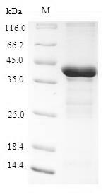 (Tris-Glycine gel) Discontinuous SDS-PAGE (reduced) with 5% enrichment gel and 15% separation gel. (Tris-Glycine gel) Discontinuous SDS-PAGE (reduced) with 5% enrichment gel and 15% separation gel.