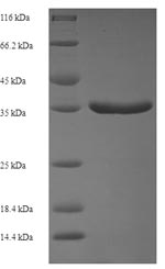 SDS-PAGE- Recombinant protein Sheep TGFA