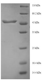 (Tris-Glycine gel) Discontinuous SDS-PAGE (reduced) with 5% enrichment gel and 15% separation gel. (Tris-Glycine gel) Discontinuous SDS-PAGE (reduced) with 5% enrichment gel and 15% separation gel.