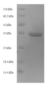 SDS-PAGE- Recombinant protein Mouse Timp1