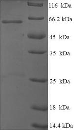(Tris-Glycine gel) Discontinuous SDS-PAGE (reduced) with 5% enrichment gel and 15% separation gel. (Tris-Glycine gel) Discontinuous SDS-PAGE (reduced) with 5% enrichment gel and 15% separation gel.