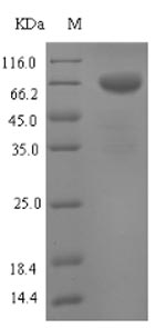 (Tris-Glycine gel) Discontinuous SDS-PAGE (reduced) with 5% enrichment gel and 15% separation gel. (Tris-Glycine gel) Discontinuous SDS-PAGE (reduced) with 5% enrichment gel and 15% separation gel.