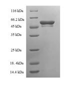 (Tris-Glycine gel) Discontinuous SDS-PAGE (reduced) with 5% enrichment gel and 15% separation gel. (Tris-Glycine gel) Discontinuous SDS-PAGE (reduced) with 5% enrichment gel and 15% separation gel.