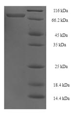 SDS-PAGE- Recombinant protein Human TRAF5