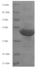 SDS-PAGE- Recombinant protein Human TRIM24