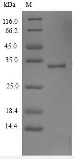 (Tris-Glycine gel) Discontinuous SDS-PAGE (reduced) with 5% enrichment gel and 15% separation gel. (Tris-Glycine gel) Discontinuous SDS-PAGE (reduced) with 5% enrichment gel and 15% separation gel.