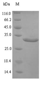 SDS-PAGE- Recombinant protein Pongo TTR