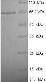 (Tris-Glycine gel) Discontinuous SDS-PAGE (reduced) with 5% enrichment gel and 15% separation gel. (Tris-Glycine gel) Discontinuous SDS-PAGE (reduced) with 5% enrichment gel and 15% separation gel.