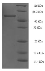 (Tris-Glycine gel) Discontinuous SDS-PAGE (reduced) with 5% enrichment gel and 15% separation gel. (Tris-Glycine gel) Discontinuous SDS-PAGE (reduced) with 5% enrichment gel and 15% separation gel.