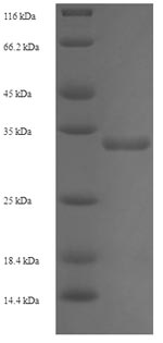 (Tris-Glycine gel) Discontinuous SDS-PAGE (reduced) with 5% enrichment gel and 15% separation gel.
