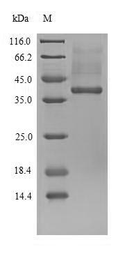 SDS-PAGE- Recombinant protein Mouse Ube3a