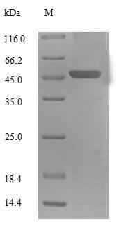 (Tris-Glycine gel) Discontinuous SDS-PAGE (reduced) with 5% enrichment gel and 15% separation gel. (Tris-Glycine gel) Discontinuous SDS-PAGE (reduced) with 5% enrichment gel and 15% separation gel.