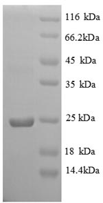 (Tris-Glycine gel) Discontinuous SDS-PAGE (reduced) with 5% enrichment gel and 15% separation gel. (Tris-Glycine gel) Discontinuous SDS-PAGE (reduced) with 5% enrichment gel and 15% separation gel.