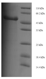 (Tris-Glycine gel) Discontinuous SDS-PAGE (reduced) with 5% enrichment gel and 15% separation gel. (Tris-Glycine gel) Discontinuous SDS-PAGE (reduced) with 5% enrichment gel and 15% separation gel.