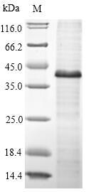 (Tris-Glycine gel) Discontinuous SDS-PAGE (reduced) with 5% enrichment gel and 15% separation gel. (Tris-Glycine gel) Discontinuous SDS-PAGE (reduced) with 5% enrichment gel and 15% separation gel.