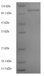 (Tris-Glycine gel) Discontinuous SDS-PAGE (reduced) with 5% enrichment gel and 15% separation gel. (Tris-Glycine gel) Discontinuous SDS-PAGE (reduced) with 5% enrichment gel and 15% separation gel.