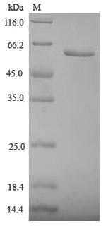 (Tris-Glycine gel) Discontinuous SDS-PAGE (reduced) with 5% enrichment gel and 15% separation gel. (Tris-Glycine gel) Discontinuous SDS-PAGE (reduced) with 5% enrichment gel and 15% separation gel.
