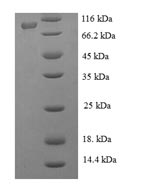 (Tris-Glycine gel) Discontinuous SDS-PAGE (reduced) with 5% enrichment gel and 15% separation gel. (Tris-Glycine gel) Discontinuous SDS-PAGE (reduced) with 5% enrichment gel and 15% separation gel.