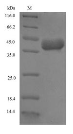 (Tris-Glycine gel) Discontinuous SDS-PAGE (reduced) with 5% enrichment gel and 15% separation gel. (Tris-Glycine gel) Discontinuous SDS-PAGE (reduced) with 5% enrichment gel and 15% separation gel.