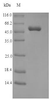 (Tris-Glycine gel) Discontinuous SDS-PAGE (reduced) with 5% enrichment gel and 15% separation gel. (Tris-Glycine gel) Discontinuous SDS-PAGE (reduced) with 5% enrichment gel and 15% separation gel.