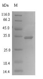 (Tris-Glycine gel) Discontinuous SDS-PAGE (reduced) with 5% enrichment gel and 15% separation gel. (Tris-Glycine gel) Discontinuous SDS-PAGE (reduced) with 5% enrichment gel and 15% separation gel.