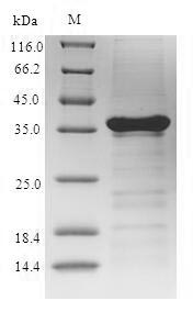 (Tris-Glycine gel) Discontinuous SDS-PAGE (reduced) with 5% enrichment gel and 15% separation gel. (Tris-Glycine gel) Discontinuous SDS-PAGE (reduced) with 5% enrichment gel and 15% separation gel.