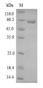 SDS-PAGE- Recombinant protein Dog DMP1