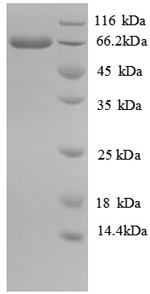 (Tris-Glycine gel) Discontinuous SDS-PAGE (reduced) with 5% enrichment gel and 15% separation gel. (Tris-Glycine gel) Discontinuous SDS-PAGE (reduced) with 5% enrichment gel and 15% separation gel.