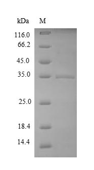 (Tris-Glycine gel) Discontinuous SDS-PAGE (reduced) with 5% enrichment gel and 15% separation gel. (Tris-Glycine gel) Discontinuous SDS-PAGE (reduced) with 5% enrichment gel and 15% separation gel.