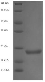 SDS-PAGE- Recombinant protein Enterobacteria stxB