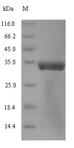 (Tris-Glycine gel) Discontinuous SDS-PAGE (reduced) with 5% enrichment gel and 15% separation gel. (Tris-Glycine gel) Discontinuous SDS-PAGE (reduced) with 5% enrichment gel and 15% separation gel.
