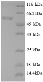(Tris-Glycine gel) Discontinuous SDS-PAGE (reduced) with 5% enrichment gel and 15% separation gel.