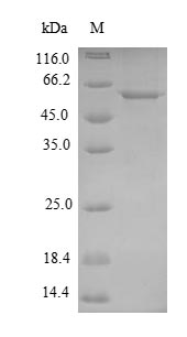 (Tris-Glycine gel) Discontinuous SDS-PAGE (reduced) with 5% enrichment gel and 15% separation gel.