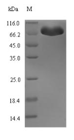 (Tris-Glycine gel) Discontinuous SDS-PAGE (reduced) with 5% enrichment gel and 15% separation gel. (Tris-Glycine gel) Discontinuous SDS-PAGE (reduced) with 5% enrichment gel and 15% separation gel.