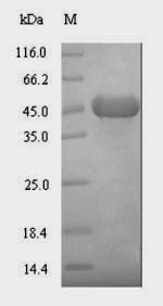 (Tris-Glycine gel) Discontinuous SDS-PAGE (reduced) with 5% enrichment gel and 15% separation gel.