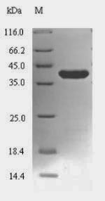 (Tris-Glycine gel) Discontinuous SDS-PAGE (reduced) with 5% enrichment gel and 15% separation gel. (Tris-Glycine gel) Discontinuous SDS-PAGE (reduced) with 5% enrichment gel and 15% separation gel.