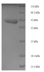 (Tris-Glycine gel) Discontinuous SDS-PAGE (reduced) with 5% enrichment gel and 15% separation gel.